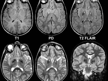 Мрт головного мозга и ангиография отличия