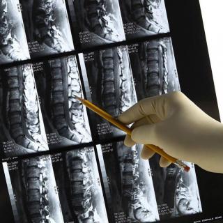 Противопоказания к МРТ позвоночника: ограничения и риски при томографии