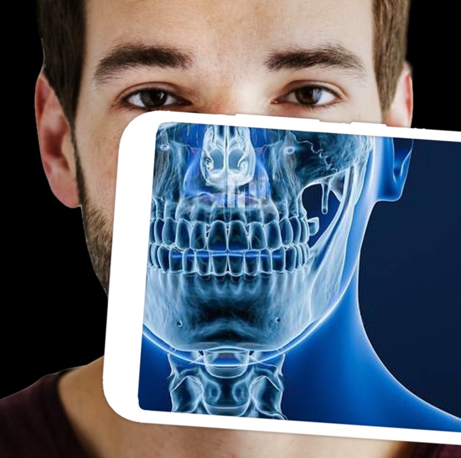 Акция цифровой рентген пазух носа